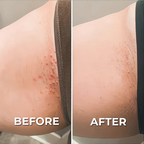 Professional Shaver